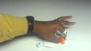 Prosthetic Finger [upl. by Lynda]