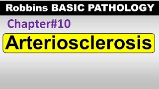 Ch10  Arteriosclerosis  Blood Vessel Pathology  Robbins Lectures [upl. by Adnomal]