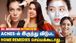 Oily Foodsனால Acne வராது What can do to get Rid of Acnes  DrMonishas Interview  IBC Tamil [upl. by Nisaj]