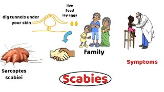 Scrabies Diagnosis Treatment Prevention [upl. by Bond]