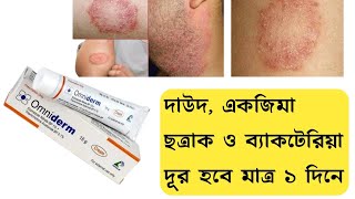 Omniderm Cream এর কাজ কি  দাউদ একজিমা চুলকানি ছত্রাক ও ব্যাকটেরিয়া দূর করার ভালো ক্রিম [upl. by Lasala]