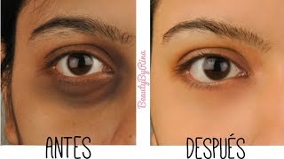 Como Eliminar Ojeras Y Bolsas En Minutos De Forma Natural [upl. by Rattray]