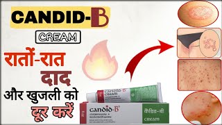 CandidB Cream Uses Benefits amp Side Effects in Hindi  CandidB Cream Ke Fayde  Medlife Coupons [upl. by Radmen688]