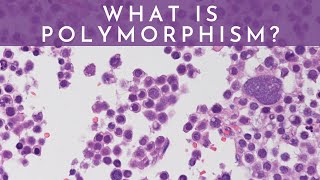 What is Polymorphism  Pathology mini tutorial [upl. by Irim]