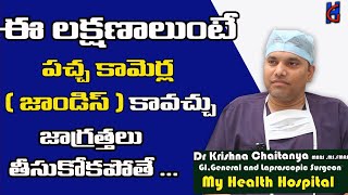 Jaundice  పచ్చ కామెర్లు  Causes Symptoms Diet and Treatment in Telugu  Dr Krishna Chitanya [upl. by Tammany]