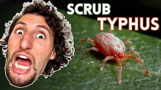 Scrub Typhus Diagnosis amp Management [upl. by Nielsen398]