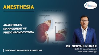 Anesthesia  Anaesthetic management of pheochromocytoma  Raaonline [upl. by Aneladgam921]