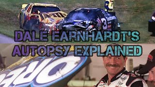 Famous Autopsies Dale Earnhardt [upl. by Adriaens]