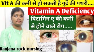 विटामिन ए की कमी से होने वाले रोग  What is vitamin A deficiency inhindi  nightblindness bitot spot [upl. by Yregerg198]