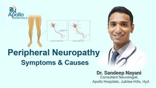 Peripheral Neuropathy Symptoms amp Causes  Dr Sandeep Nayani Neurologist  Apollo Hospitals Hyd [upl. by Ettenay]