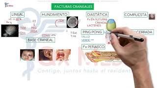 Neurocirugía  1 Traumatismo encéfalo craneano [upl. by Lorna]