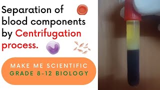 Separation of Human Blood Components by Centrifugation Process  Grade 812  Biology Demo [upl. by Remde]