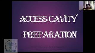 Access Cavity Preparation [upl. by Perreault]