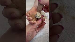 Removing callus from kid hands  Keratoderma hyperkeratosis EPPK skin shaving callous  Apr 2 2023 [upl. by Ruffina601]