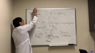 Third nerve palsy vs Edinger Westphal lesion [upl. by Gildea953]