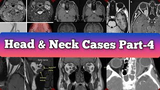 Radiology Viva Cases  393398  Head and Neck Exam Cases Part 4 medical radiology [upl. by Karilynn645]