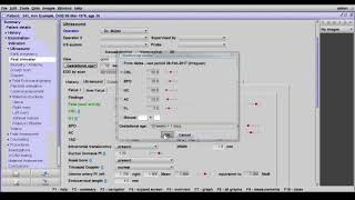 astraia First Trimester Screening module [upl. by Essilec126]