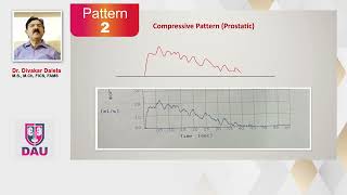 Uroflowmetry How to interpret Flow Patterns [upl. by Idnarb]