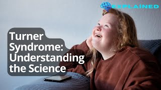 Turner Syndrome Understanding the Science [upl. by Akahc]