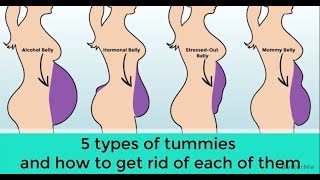 5 types of tummies and how to get rid of each of them [upl. by Ayotak]