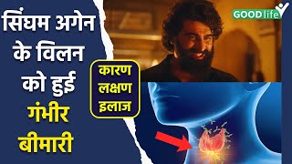 Arjun Kapoor Suffering From Hashimoto Thyroiditis Causes Symptoms Treatment In Hindi [upl. by Ojimmas215]