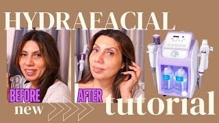 Honest Review  Mychway Hydro Dermabrasion Machine For Home Use Instant Glowing Skin HYDRAFACIAL [upl. by Akimik]