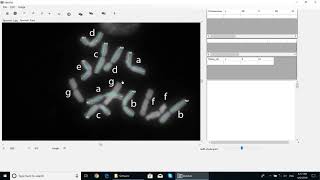 IdeoKar training videoFree karyotyping tool [upl. by Ramu]