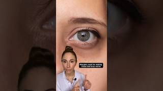 How To Get Rid Of Dark Circles Under Your Eyes dermatologist [upl. by Atrebla890]