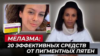 Как избавиться от мелазмы Лучшие средства от пигментации Избавься от пигментных пятен [upl. by Nosemaj]