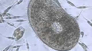 Ciliate Phylum of Protozoa [upl. by Clayborn]