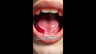 The Healing Powers of Saliva Natures Miracle [upl. by Durst561]