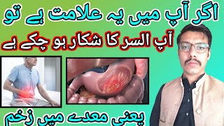 ulcer symptoms in urdu UlserTreatment [upl. by Landre]