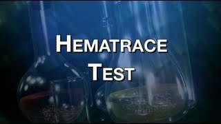 Hematrace Test [upl. by Pussej568]