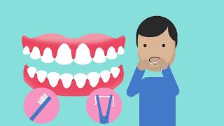 Explaining gum disease [upl. by Emerson]