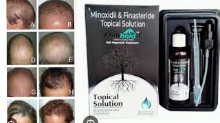 Folltholo F Topical Solution Minoxidil amp Finasteride Topical Solution [upl. by Darcia48]