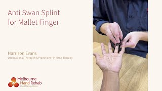 Anti Swan Splint for Mallet Finger [upl. by Retloc]