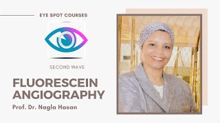 Fluorescein angiography by Prof Dr Nagla Hasan [upl. by Aislehc893]