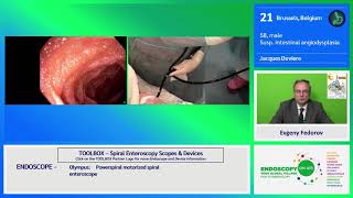 EOA 2020 Case 17 spiral enteroscopy Deviere [upl. by Oninotna330]