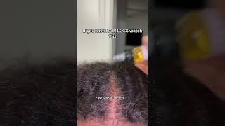 If your hair doesnt grow watch this haircare naturalhair hairgrowth naturalhairtips longhair [upl. by Balbur]