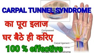 CARPAL TUNNEL SYNDROME TREATMENT Complete Cure  100  Effective Treatment Of CTS [upl. by Strohl]