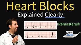 Heart Blocks Explained  First Second Third Degree and Bundle Branch on ECG [upl. by Naarah]