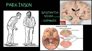 Parkinson Hastalığının Biyolojik Temelleri Psikoloji  Akıl Sağlığı Sağlık Bilgisi ve Tıp [upl. by Fredi386]