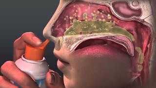 Can Saline Irrigation Help Nasal Allergies Animated Guide to Saline Nasal Irrigation [upl. by Idac673]