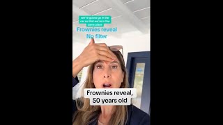 Frownies results on a 50 year old [upl. by Merideth]