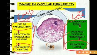 Acute inflammation [upl. by Giuliana729]