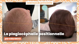 🏃 Plagiocéphalie et torticolis du nourrisson  la plagiocéphalie positionnelle avec Cléa SECCI [upl. by Silvain704]