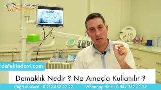 Damaklık Nedir Neden Kullanılır amp Dr Onul Üner [upl. by Ynohtnaeoj]