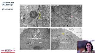 TrastuzumabDeruxtecan modulates HER2 breast cancer cell fate and immune microenvironment [upl. by Yboj561]