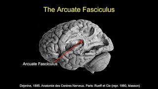 CARTA Comparative Anthropogeny Human Arcuate Fasciculus [upl. by Nilekcaj858]