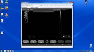 Capturing Flowmediated Dilatation Data using Medical Imaging Applications Software Part I [upl. by Ahsinehs]